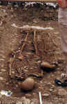 bones